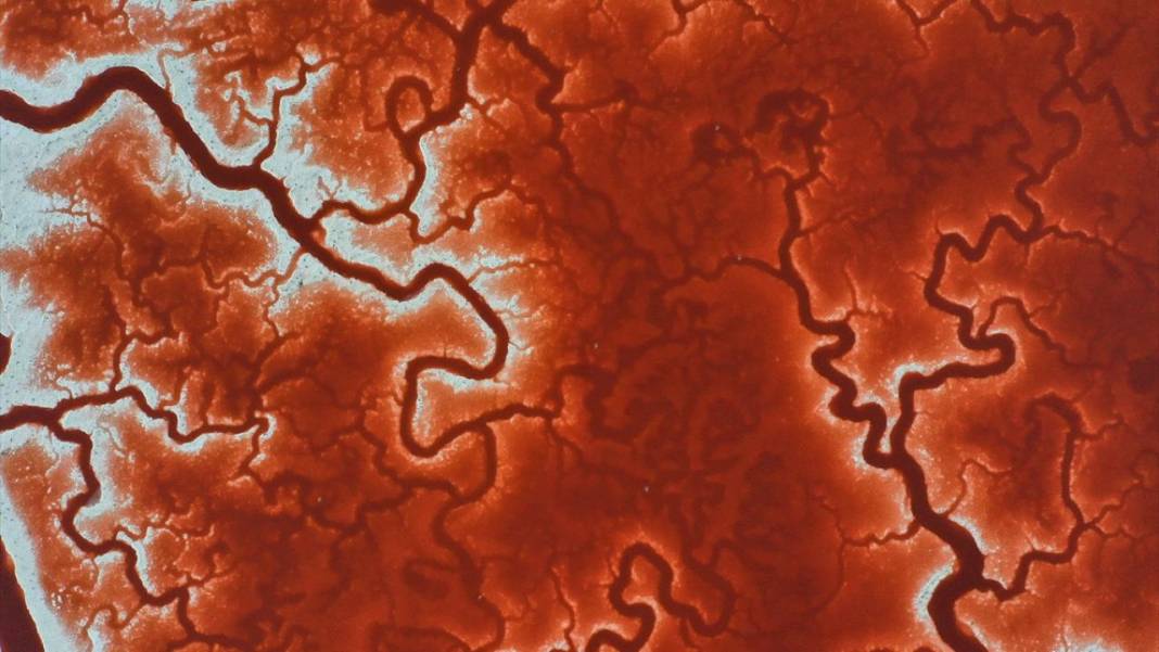 Bu görüntüler vücuttaki damar veya kan dolaşımı değil 6