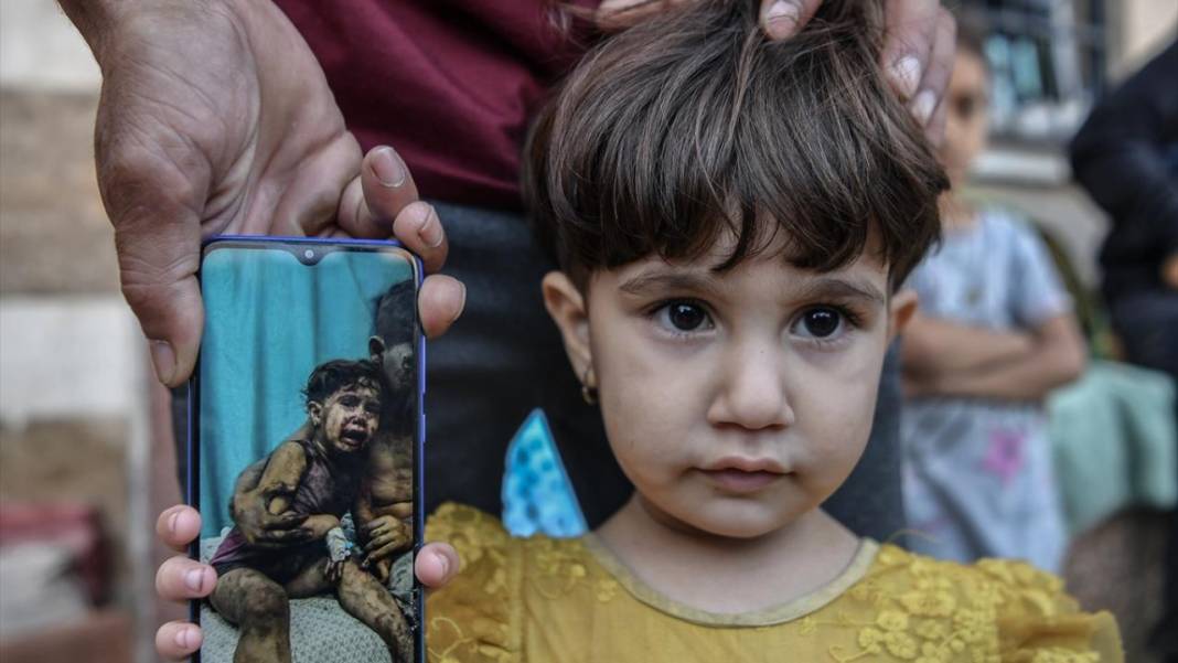 Filistinliler, Nasır Hastanesi'ne sığınarak hayatlarına devam etmeye çalışıyor 4