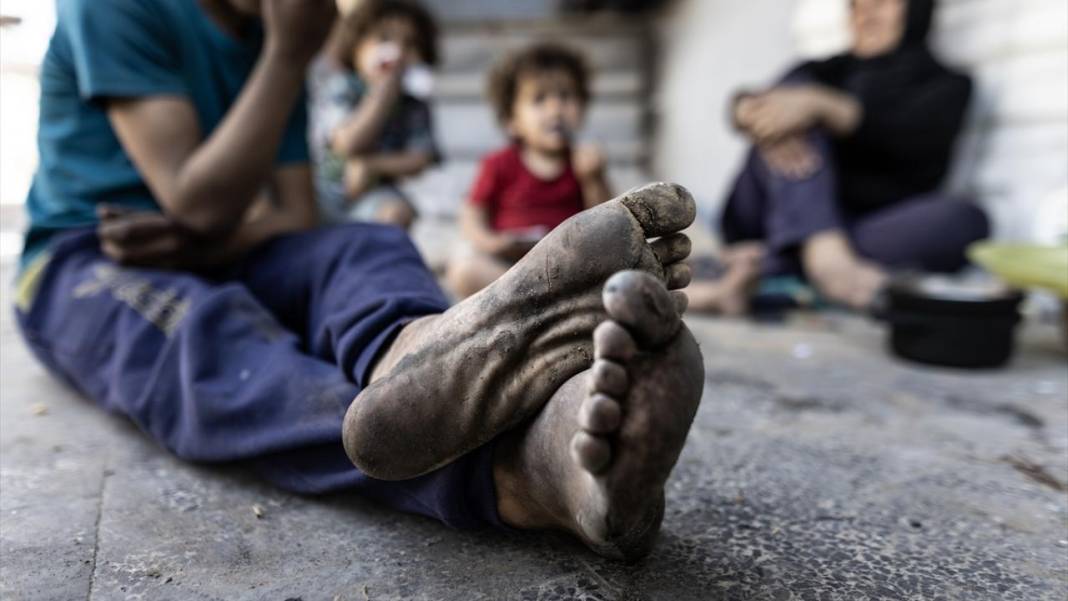 Saldırı altındaki Gazze'de günlük yaşam 15