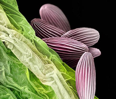 Nezle yapan polen hücreleri 11