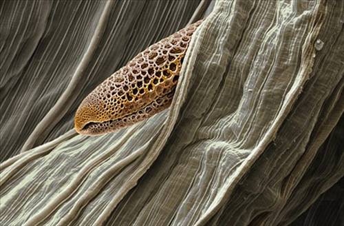 Nezle yapan polen hücreleri 12