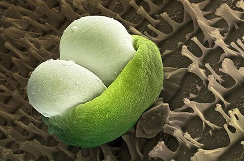 Nezle yapan polen hücreleri 13