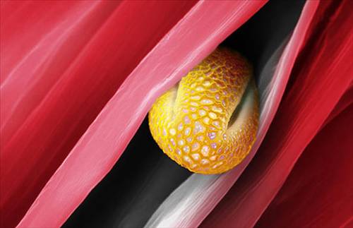 Nezle yapan polen hücreleri 2