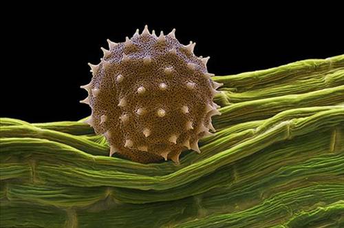 Nezle yapan polen hücreleri 5