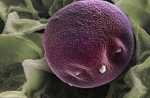 Nezle yapan polen hücreleri 9