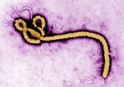 Kongo'da ebola salgını: 10 ölü