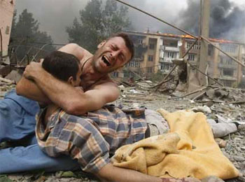 Yüreğimiz yanıyor, dünyada kan kanıyor