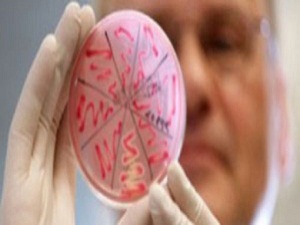 Ortadoğu'da SARS'a benzeyen virüs alarmı