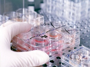 Gözdeki Proteinler Bakterilerle Savaşıyor