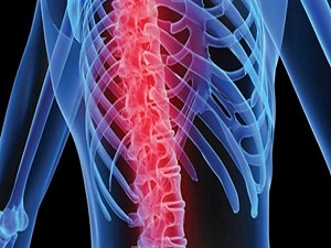 Fıtık ameliyatı dengeyi bozuyor!