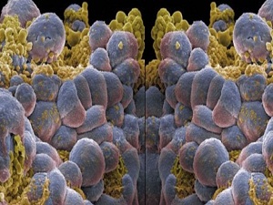 Her yıl bin 500 çocuk lösemi oluyor