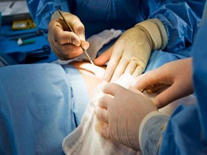 Bu yöntemle kanserli hastaların yaşam süresi uzatılıyor