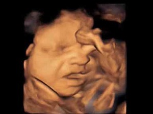 Anne karnındaki bebeğin esnemesi görüntülendi