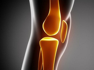 Menisküs zedelenmesi en fazla kadınlarda görülüyor
