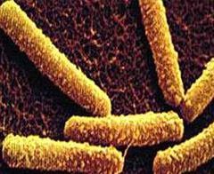 Oksijen olmadan yaşayabilen canlı bulundu