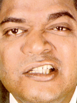 Mevsim yüz felci mevsimi!