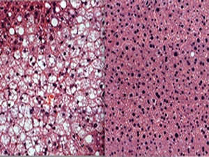 Haftada 2 gün oruç tut, kanserden korun!