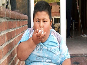 Obezite insan ömrünü 13 yıl kısaltıyor!