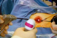 Türk doktorlar bir ilke imza attı