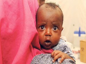 Pakistan’da 210 çocuk kızamık kurbanı