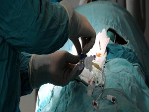 Kalp deliği tedavisinde yeni yöntem