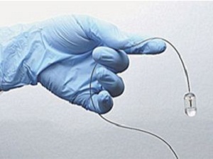 Akupunktur 70 hastalığa umut oldu