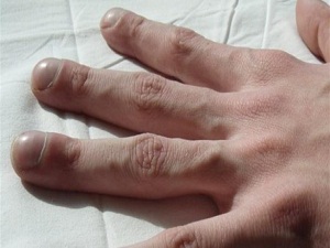 Parmaklarınıza iyi bakın!