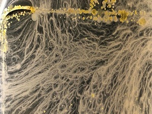 Bu bakteriler cebimizde yaşıyor