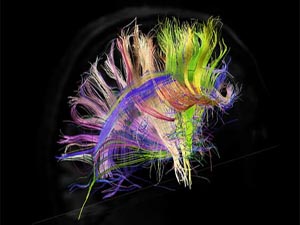 İşte insan beyninin en ayrıntılı görüntüleri