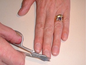 Derin kesilen tırnak mantar oluşturuyor