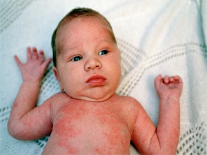 Ter, egzamayı tetikliyor