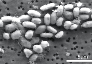 ABD hastanelerinde ölümcül bakteri