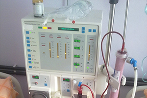 ‘Diyaliz havuzuna yıllık ortalama 7 bin hasta ekleniyor’