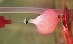 Yapay böbrekte ilk büyük adım