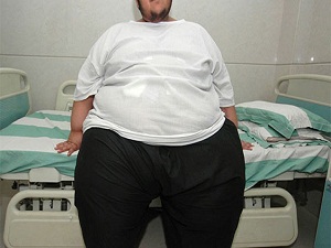 Obezite, içinden çıkılmaz hale gelecek