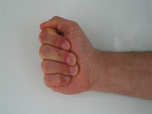 Sabahları ellerinizi yumruk yapamıyorsanız dikkat