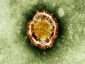 Suudi Arabistan'da corona virüsü yayılıyor