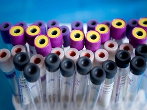 Kansızlık kanserin habercisi olabilir