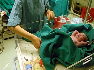 Doğum koçları cesaret aşılayacak