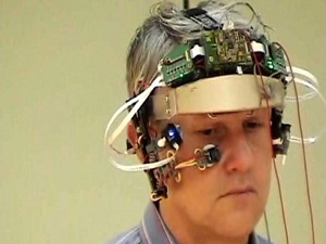 Türkiye'de her yıl 150 bin kişi felç geçiriyor