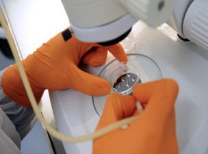 Felç tedavisinde kök hücre umudu