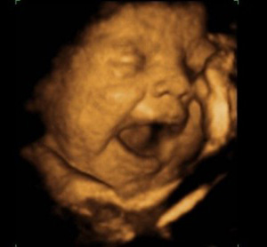 Bebekler ana karnında 'ağlama provası' yapıyor