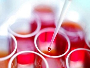 Kan Aldırmak Orucu Bozar mı?