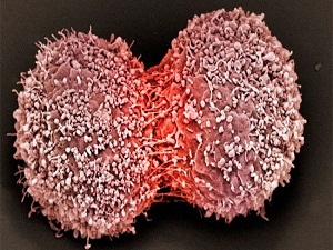 Mobil erken teşhis projesi Sağlık Bakanlığına örnek oldu