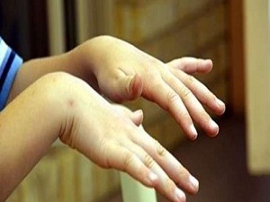 Eğer elleriniz titriyorsa bunlara dikkat