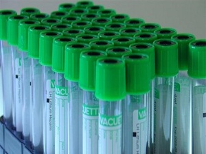 Terle teşhis koysunlar