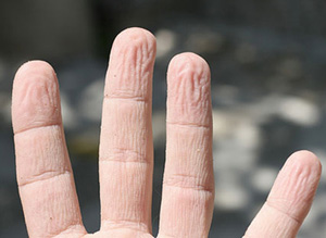 İşte parmakların buruşmasındaki hikmet