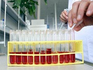 EÜ hemofili hastalarının umudu olacak