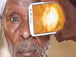 Cepten katarakt teşhisi