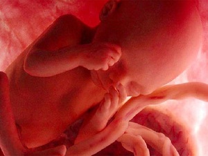 Anne karnındaki bebeğin kromozom hastalıkları tespit edilebiliyor